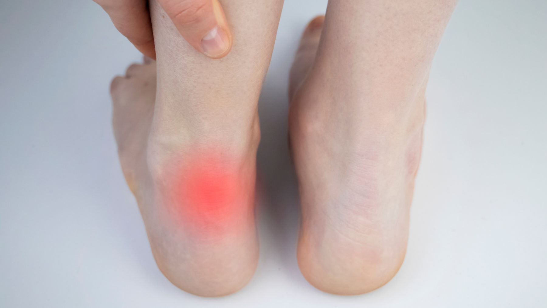 Hydrodysekcja ścięgna Achillesa